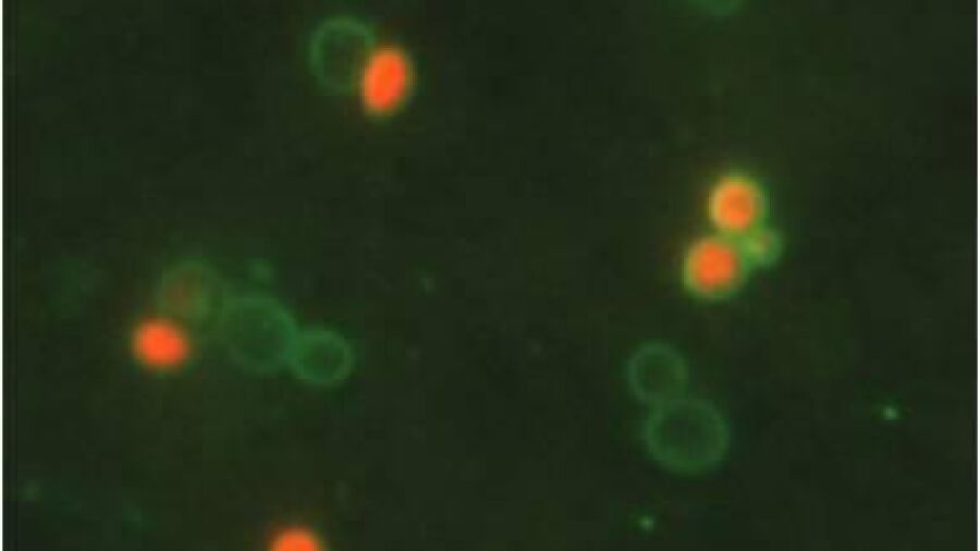 Nieuwe methode geeft snelle indicatie aanwezigheid legionella