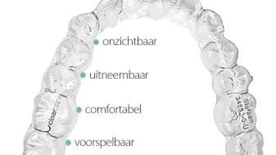 Hippe onzichtbare beugel verovert terrein
