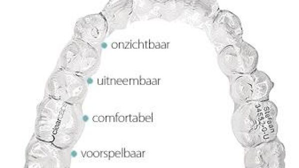 Hippe onzichtbare beugel verovert terrein