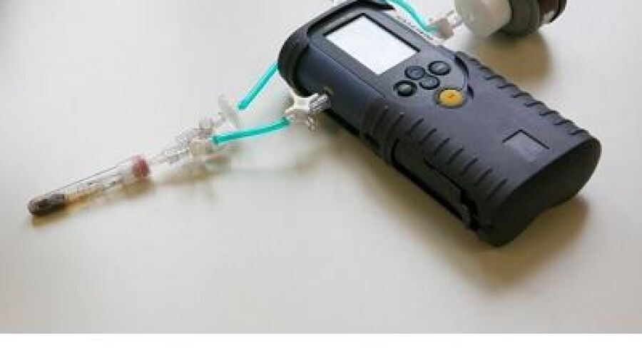Elektronische neus í¢äåìruiktí¢äåä¢ darmkanker in menselijke ontlasting