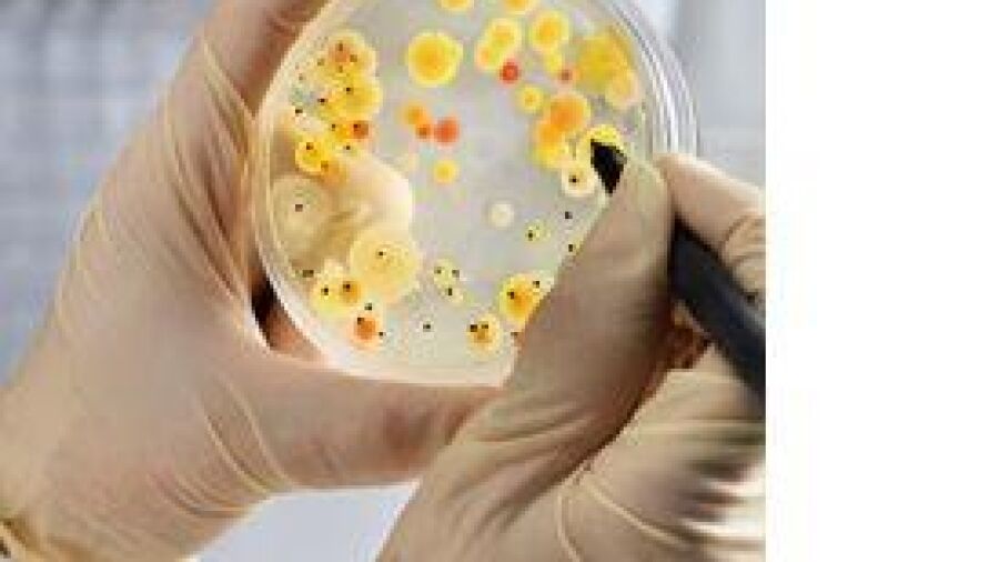 Escherichia Coli (E. coli) in Roquefort