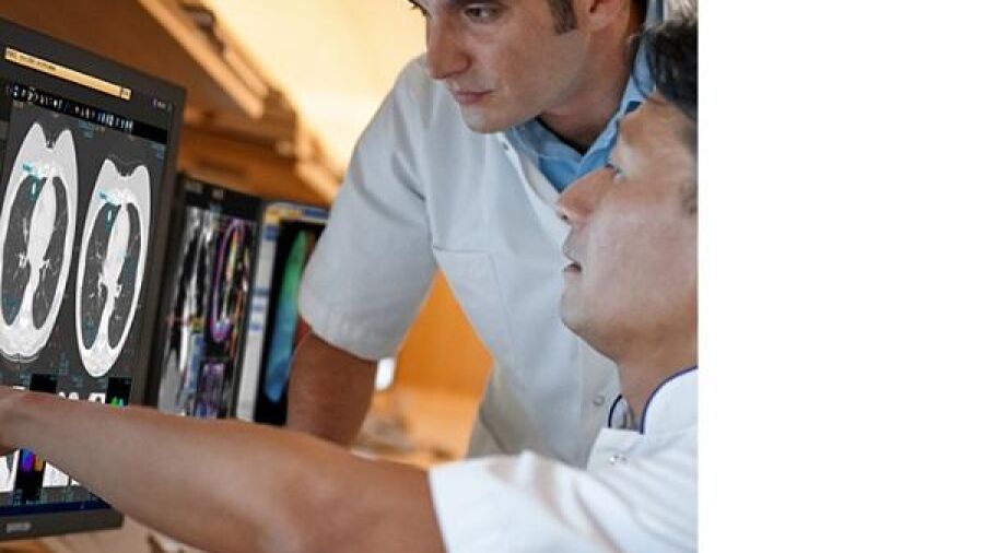 Nieuwe digitale radiologische mogelijkheden voor geavanceerde kankerdiagnose en -behandeling