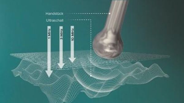 Ultrasone golven tegen rimpels, een onzuivere of gevoelige huid, littekens, striae en cellulitus