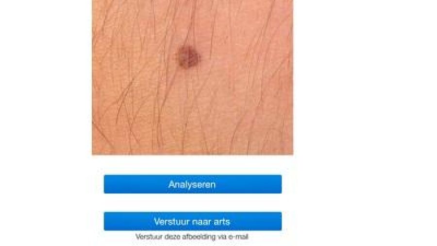 Nederlandse huidkanker app behaalt Europese certificering